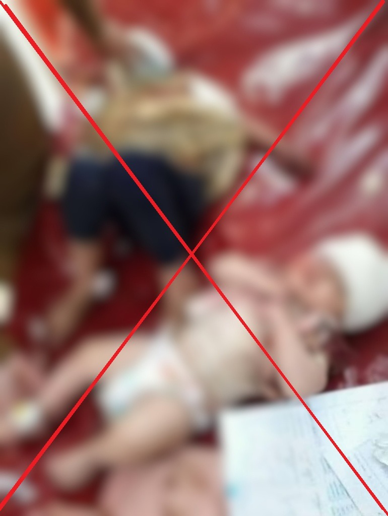 Viral image of injured infants is not from recent security operation in KP's Bajaur
